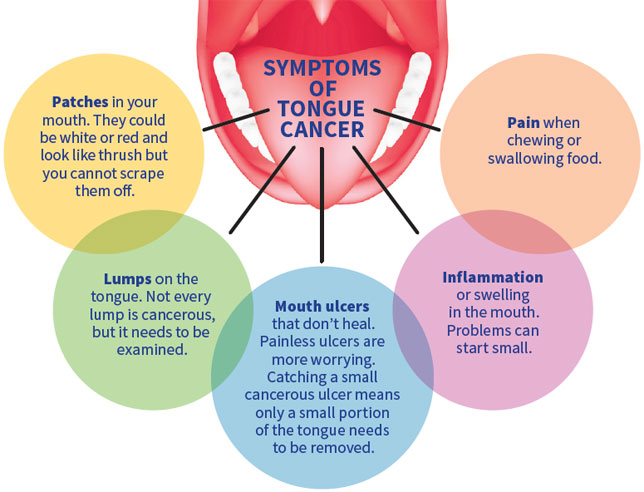 what-is-tongue-cancer-new-health-advisor