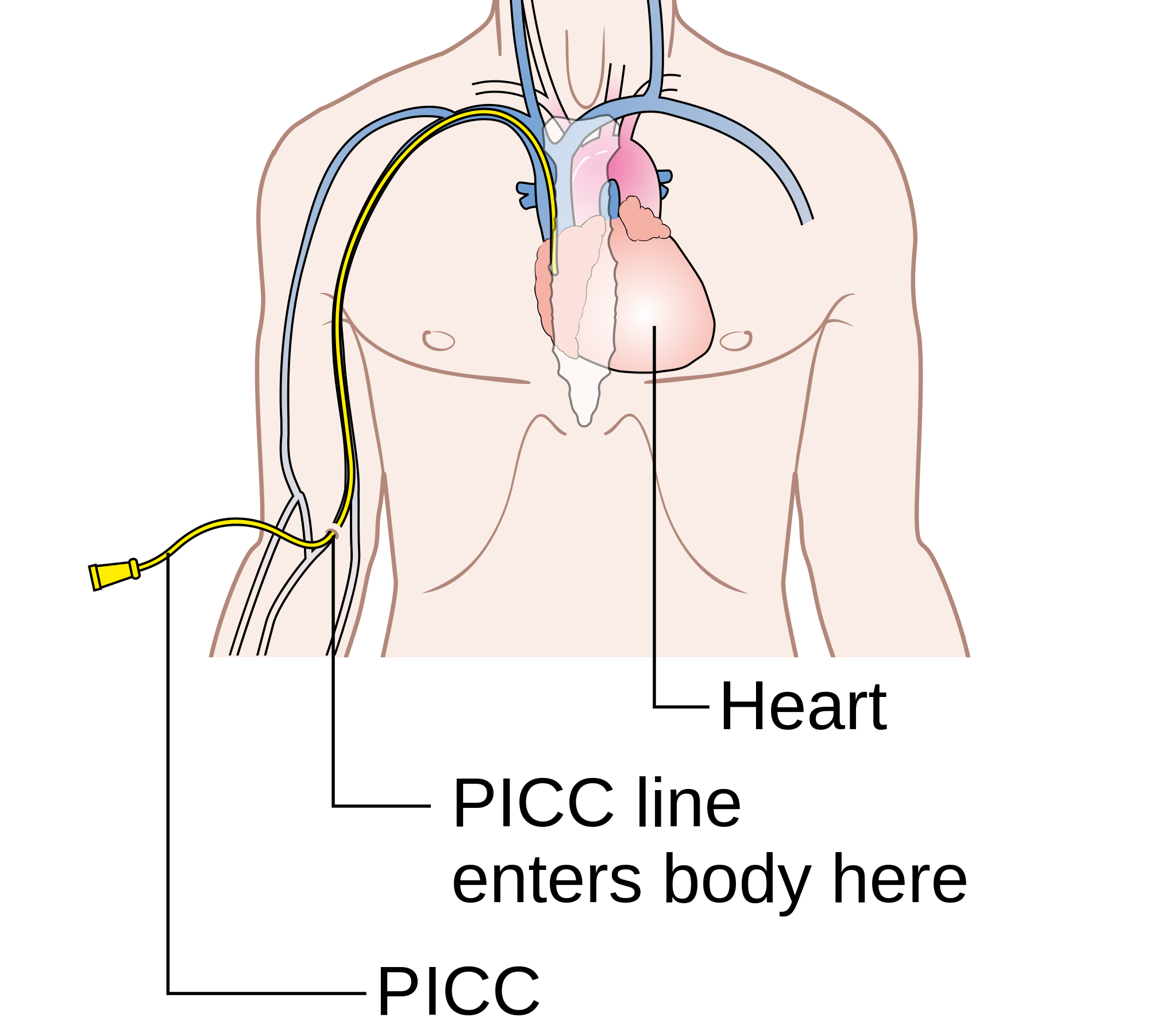 Complications And Care Of Peripherally Inserted Central Catheters Picc Line New Health Advisor